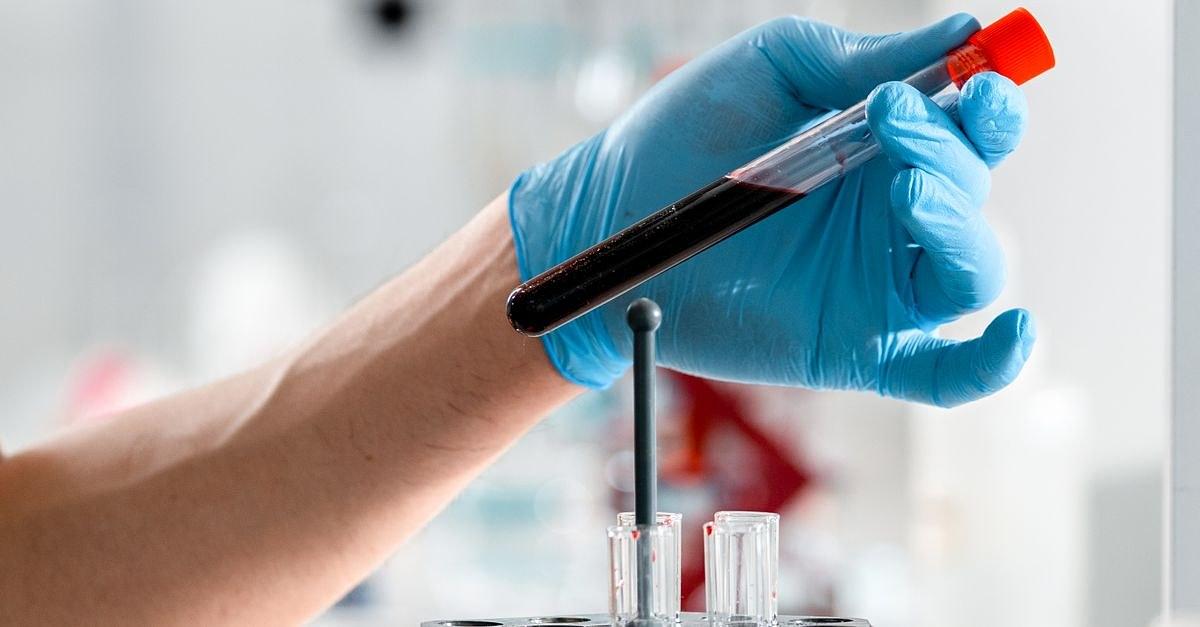 Close-up of a gloved hand holding a test tube with blood sample in a clinical research lab.