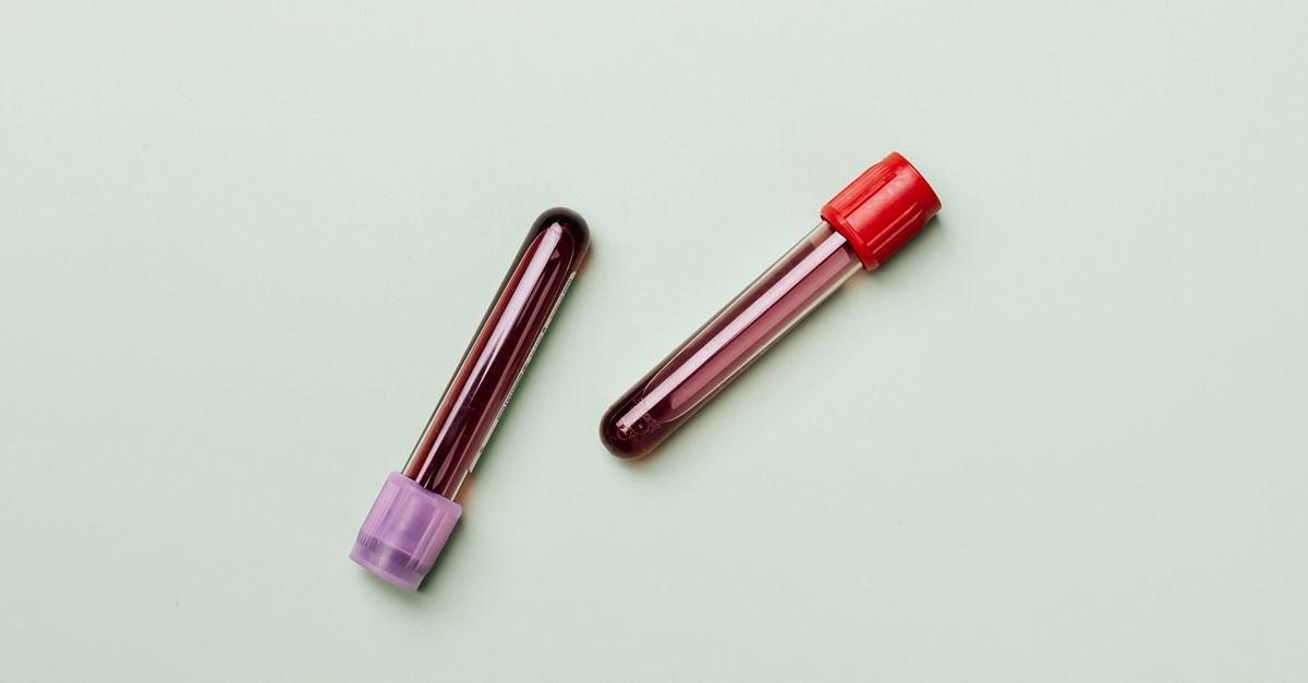 Blood samples in test tubes on a light background, ideal for medical and laboratory themes.