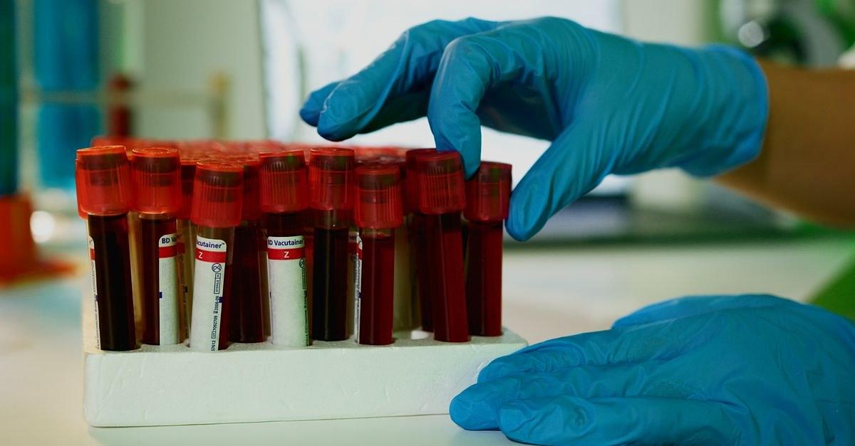 A lab technician handles blood vials in a laboratory setting, showcasing medical research.