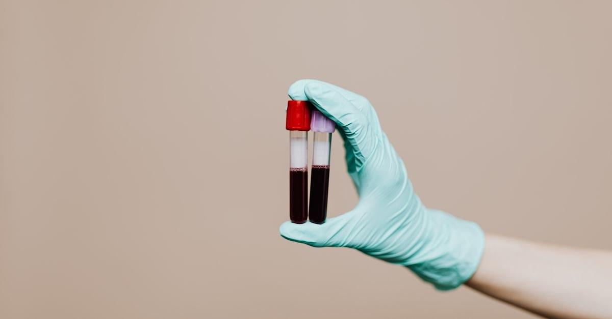 Close-up of a gloved hand holding two blood sample tubes in a laboratory setting.