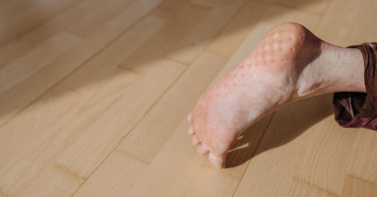 A detailed close-up of a human foot resting on a wooden floor indoors.